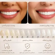 بهترین رنگ لمینت دندان چیست؟ راهنمای انتخاب رنگ لمینت برای پوست سبزه و سفید