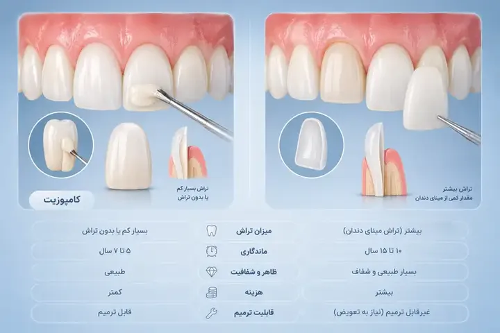 لمینت بهتر است یا کامپوزیت؟ مقایسه کامل مزایا، معایب، ماندگاری و زیبایی