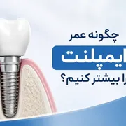 مراقبت بعد از ایمپلنت دندان؛ راهنمای کامل افزایش طول عمر ایمپلنت و جلوگیری از عوارض