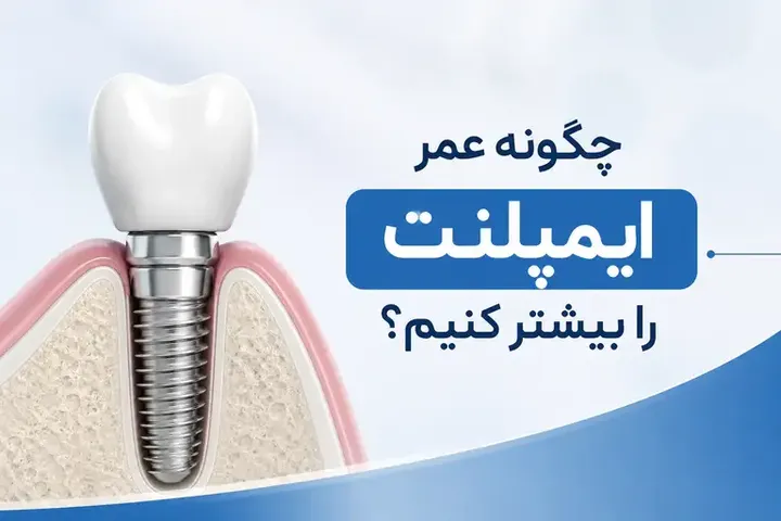 مراقبت بعد از ایمپلنت دندان؛ راهنمای کامل افزایش طول عمر ایمپلنت و جلوگیری از عوارض