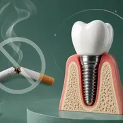 ایمپلنت دندان برای افراد سیگاری؛ آیا سیگار باعث شکست ایمپلنت می‌شود؟