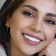 لمینت دندان چند سال ماندگاری دارد؟ بررسی عوامل مؤثر بر طول عمر لمینت