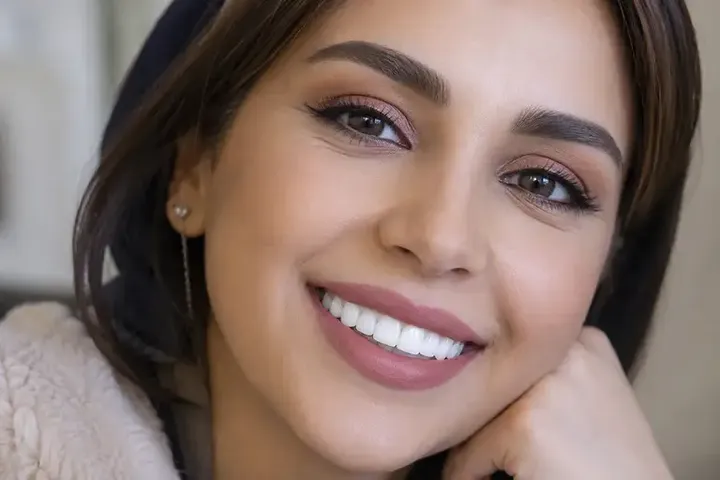 لمینت دندان چند سال ماندگاری دارد؟ بررسی عوامل مؤثر بر طول عمر لمینت