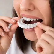 لمینت متحرک چیست؟ آیا طراحی لبخند موقت ارزش انجام دارد؟