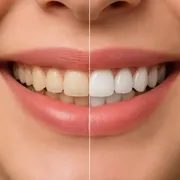 راز لبخندهای یکدست و طبیعی با کامپوزیت دندان در کاشان